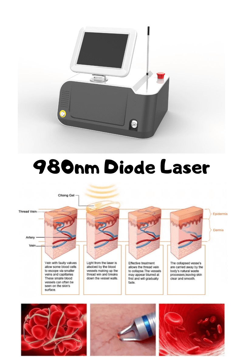 980nm diode laser machine