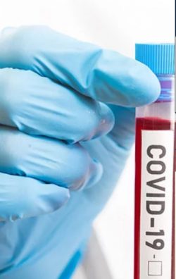 COVID-19 Virus Qualitative PCR