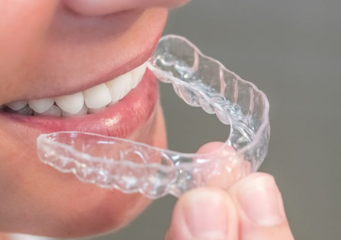 Find an Invisalign Doctor Near Me