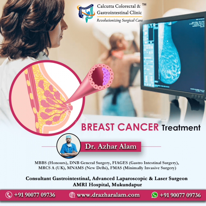 Best Breast Tumor Treatment In Kolkata | Dr. Azhar Alam
