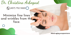 Remove Wrinkles with Anti-Aging Acupuncture Treatment