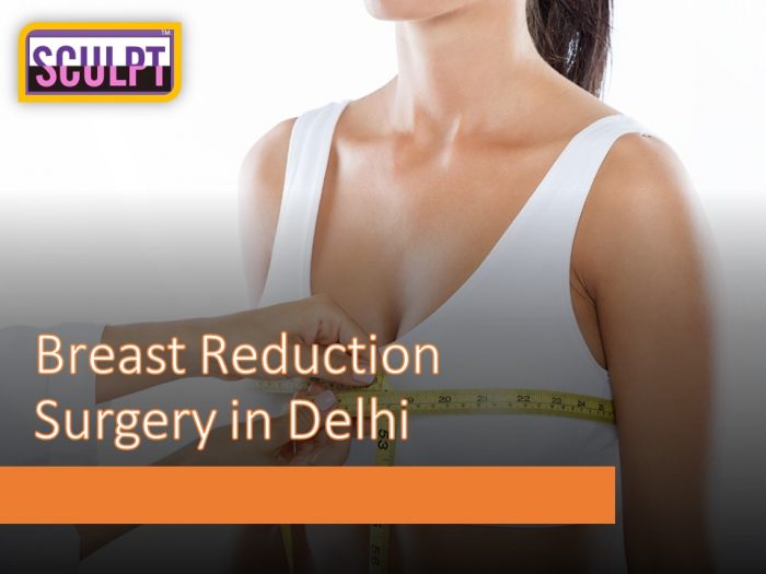 Breast Reduction Surgery in Delhi for Bigger Breast – Dr. Vivek Kumar