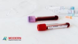 Blood Test Home Collection Services in Jaipur