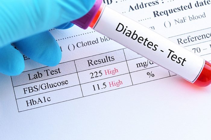 Diabetes Test in Bangalore| Get 51.9% OFF