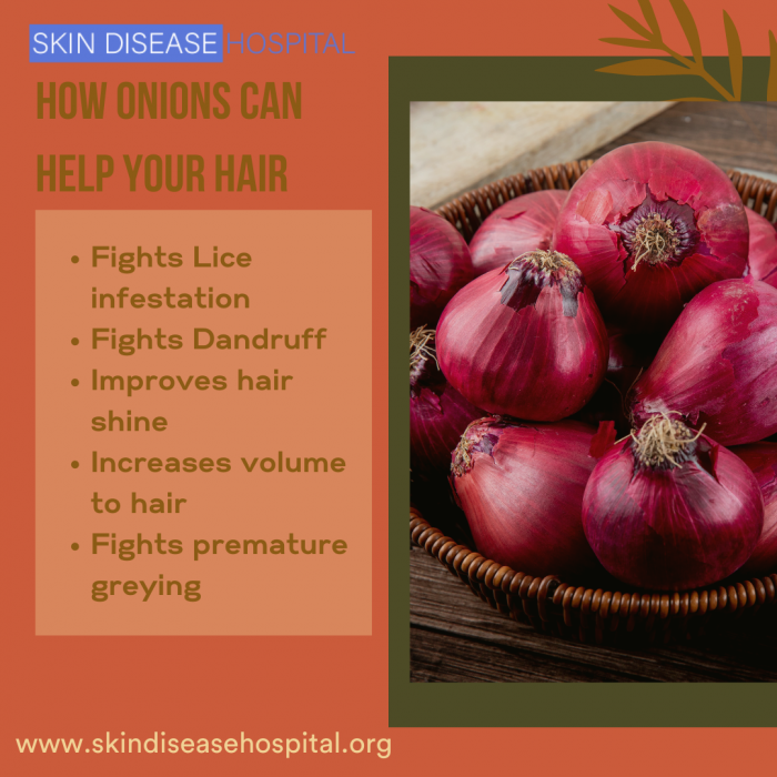 How can onion help your hair