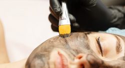 What Does Laser Skin Rejuvenation Do? – Bared Monkey