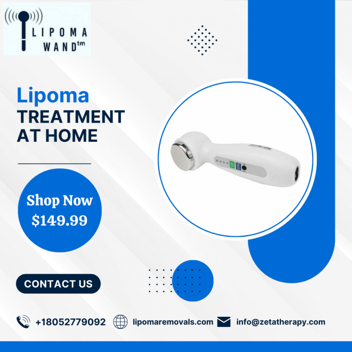 Lipoma Treatment at Home – Lipoma Wand