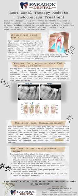 Root Canal Therapy Modesto | Endodontics Treatment