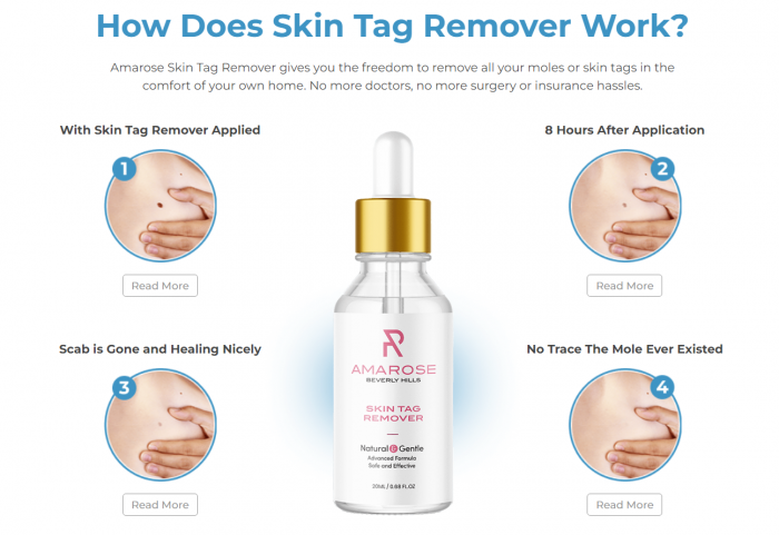 Amarose Skin Tag Remover – Moisturizer With Ultimate Skin Benefits