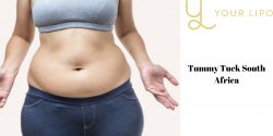 Famous Tummy Tuck Treatment In South Africa