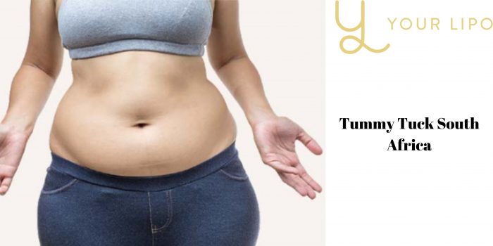 Famous Tummy Tuck Treatment In South Africa