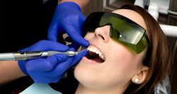 Laser Gingivectomy Near Me In Houston