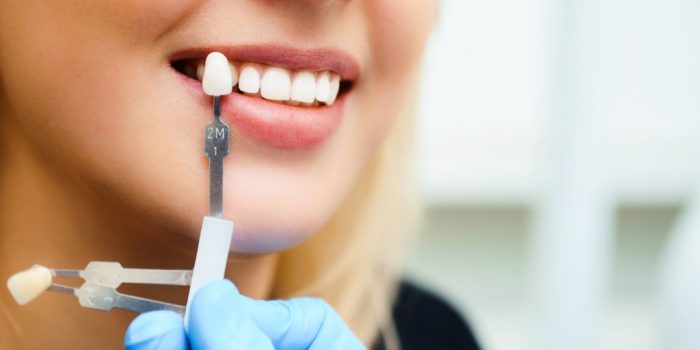 How Long Does the Dental Implant Process Take?