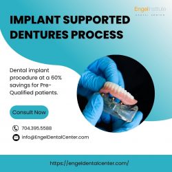 Are You Getting The Right Implant Supported Dentures Cost?