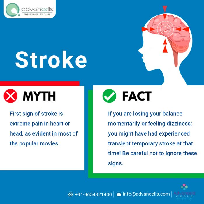 Stroke Myths and Facts