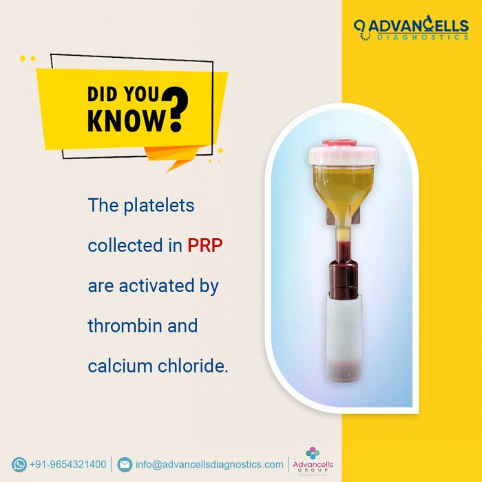 Did You Know about PRP Kit?