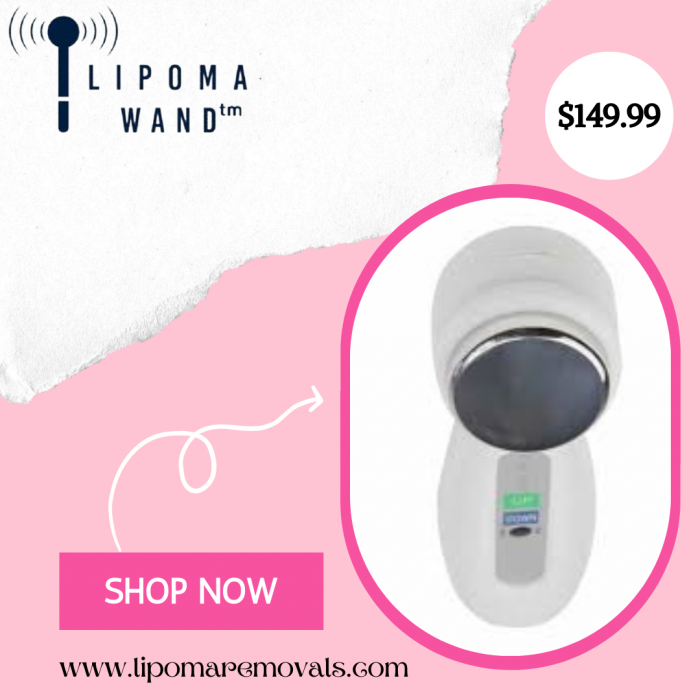 Best Way For Lipoma Treatment Without Surgery – Lipoma Wand