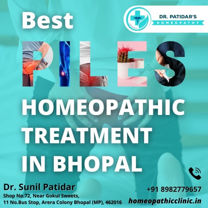 Bhopal Best Piles Homeopathic Treatment