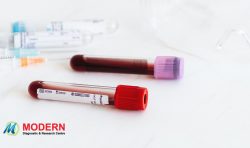 Blood Test Centres At Home in Jaipur