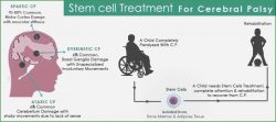 Stem Cell Therapy for CP Child in India