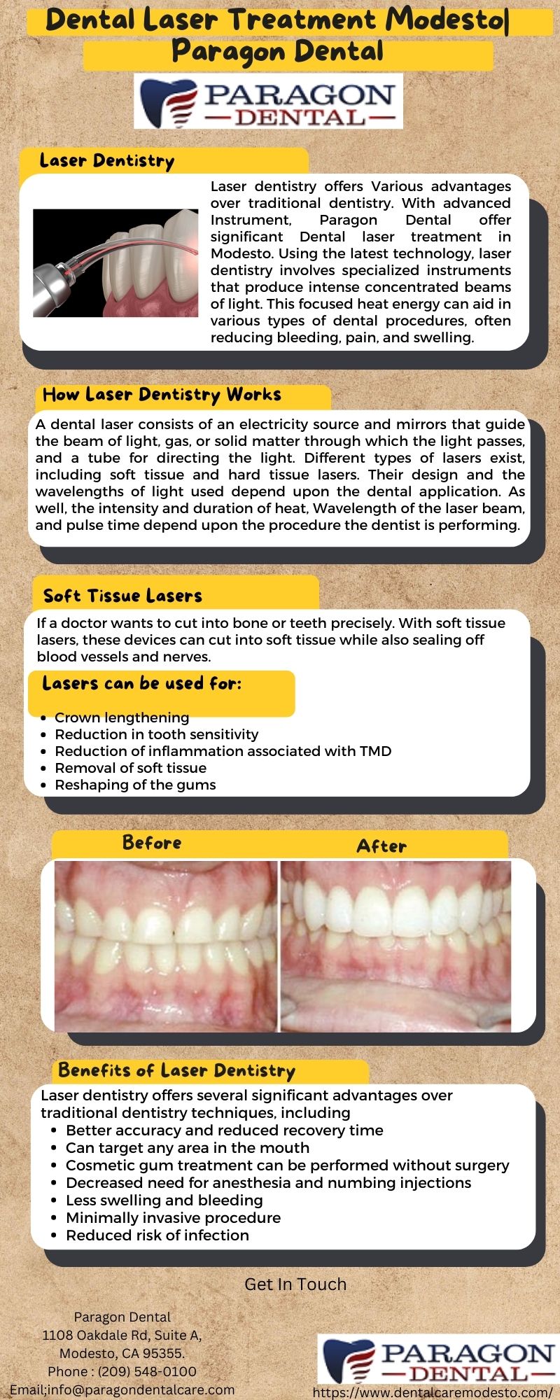 Dental Laser Treatment Modesto| Paragon Dental