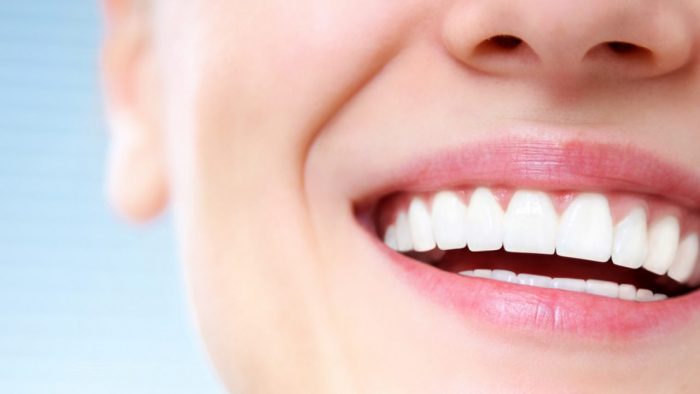 What is Snap-On Smiles?