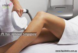 IPL hair removal Singapore