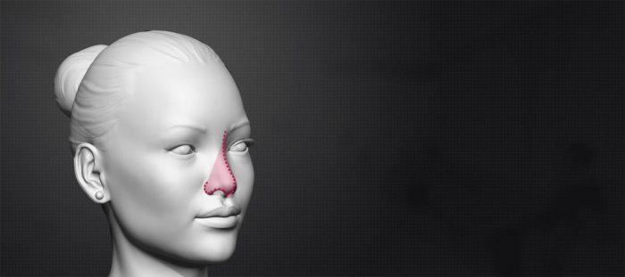 Affordable Rhinoplasty Cost in India