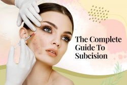 The complete guide to Subcision | subcision scar treatment