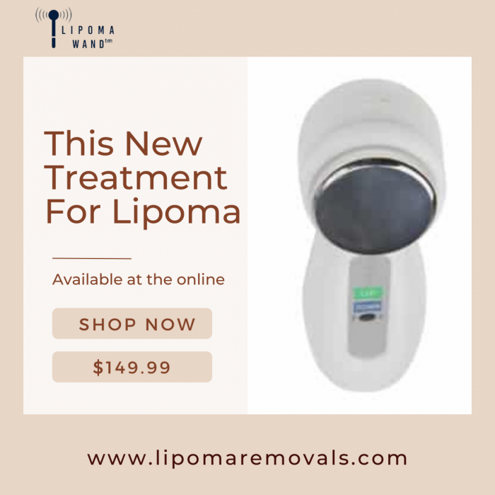 Get New Treatment For Lipoma | Lipoma Removals