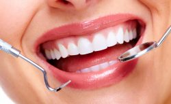 Effective Ways to Take Care of Your Porcelain Veneers