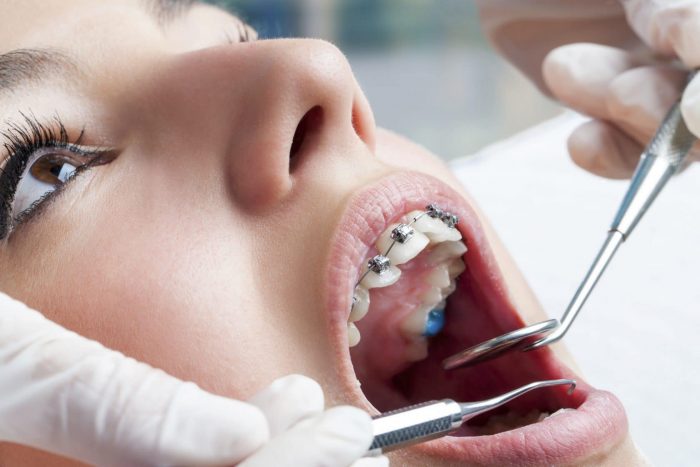 How Can a Dentist Open on Saturday Help You?