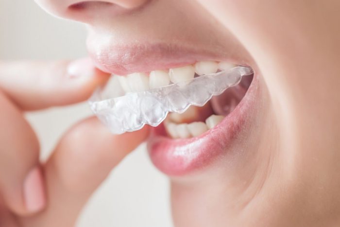 What Are The Benefits Of Orthodontics?