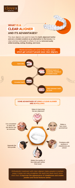What is a Clear Aligner and its Advantages?