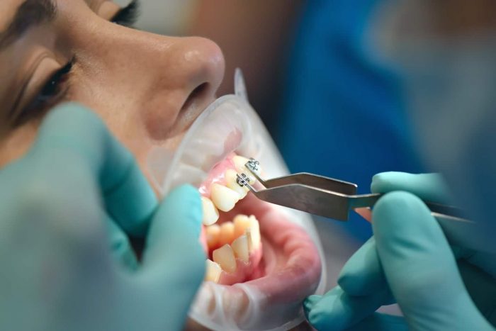 Miami Shores Orthodontist Specialists