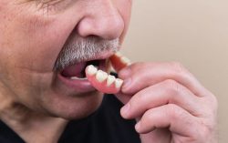 Dental Implants & Dentures in Houston, TX