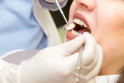 Dental Clinic Aventura | Dental Braces | Gentle Braces