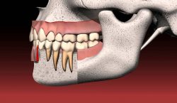 How Much Does A Dental Bridge Procedure