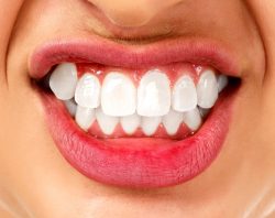 Teeth Whitening | Risks, Results, Options and Cost