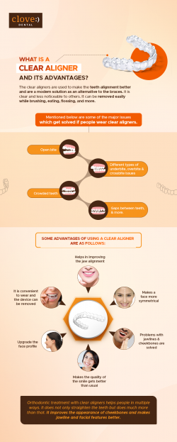 What is a Clear Aligner and Its Advantages?