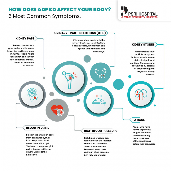 How Does ADPKD Affect Your Body? 6 Most Common Symptoms.