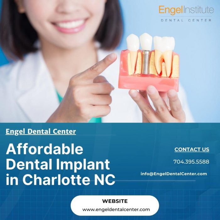 How Much Do All-On-4 Dental Implants Cost?
