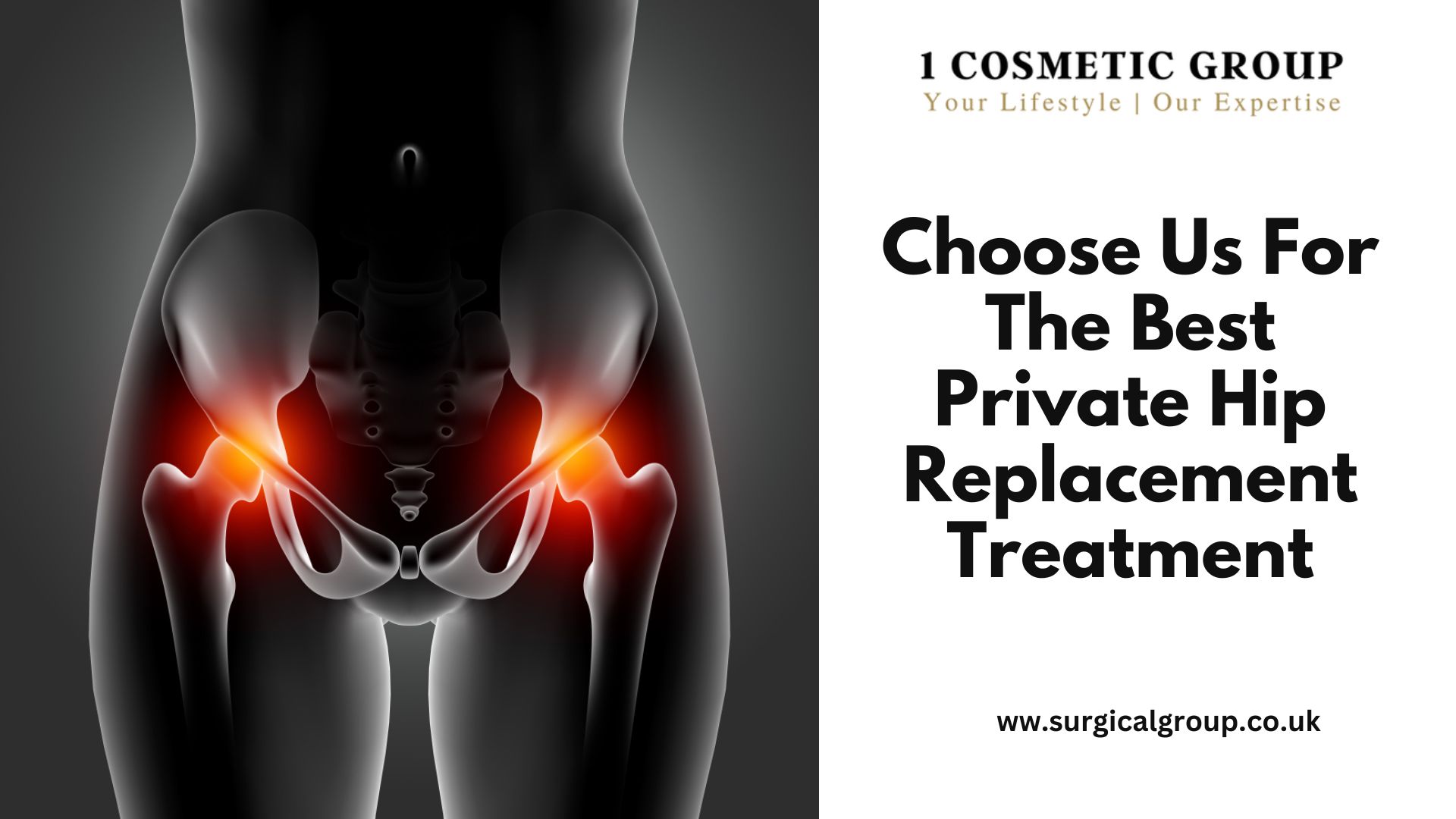 Choose Us For The Best Private Hip Replacement Treatment - Social Social Social | Social Social ...