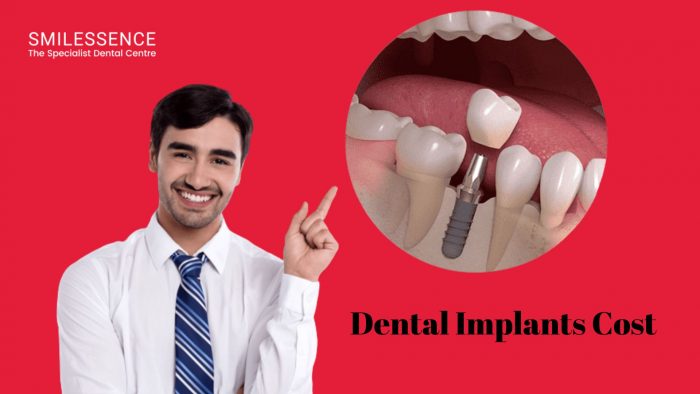 Dental Implants Cost in Gurgaon