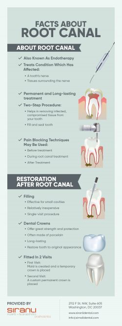 Get Professional Root Canal Treatment From Siranli Dental In Washington, DC