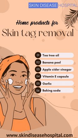 Home products for skin tag removal