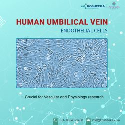 Human umbilical vein endothelial cells