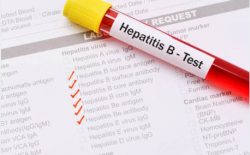 hepatitis b surface antigen test price