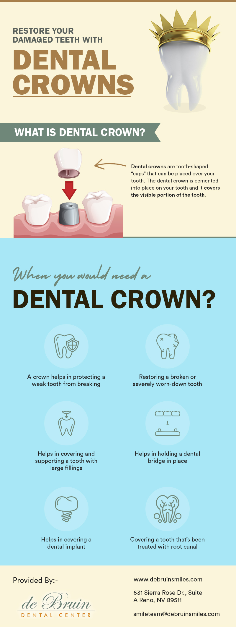 Restore Your Broken Or Damaged Teeth At de Bruin Dental Center From Our Dental Crowns Dentist in ...
