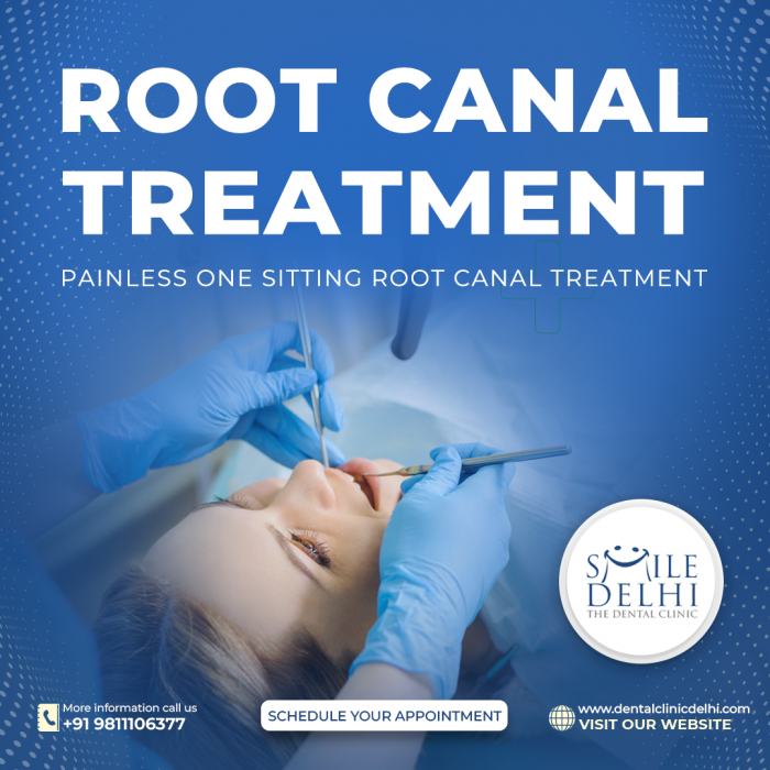 Root Canal Treatment